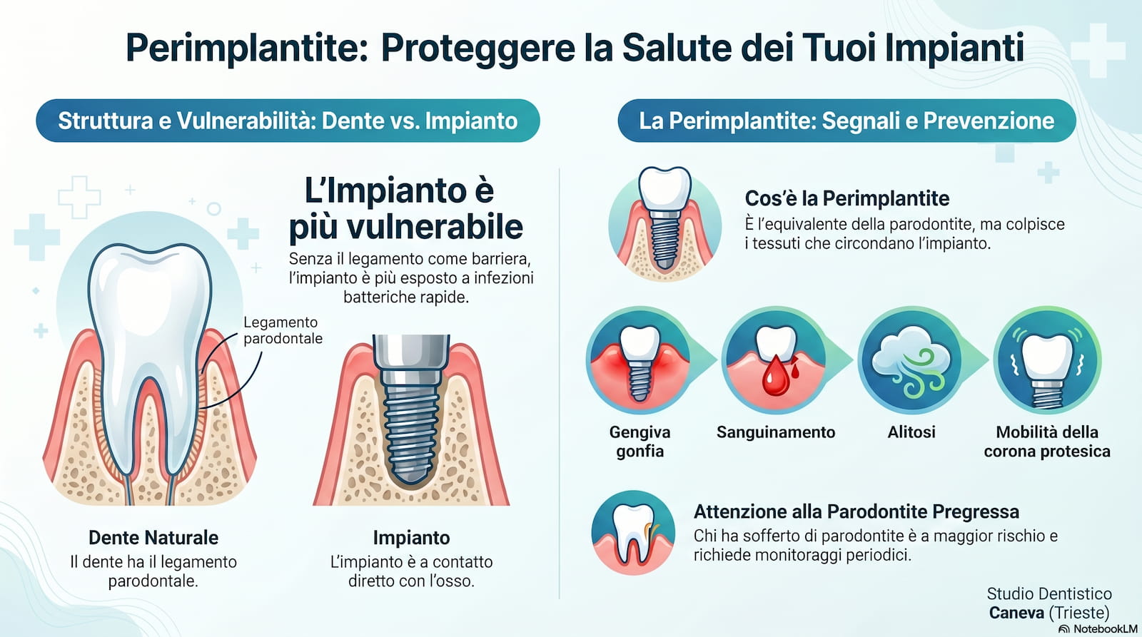 Parodontite Trieste – Studio Dentistico Caneva