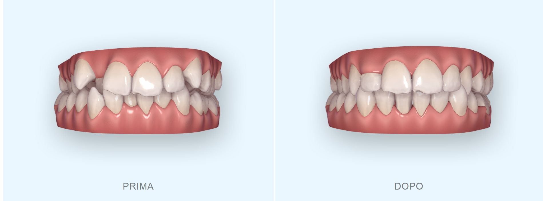 Freqty Presenta Lo Scanner Intraorale PANDA P3 All'AEEDC 2023 - Foto 8