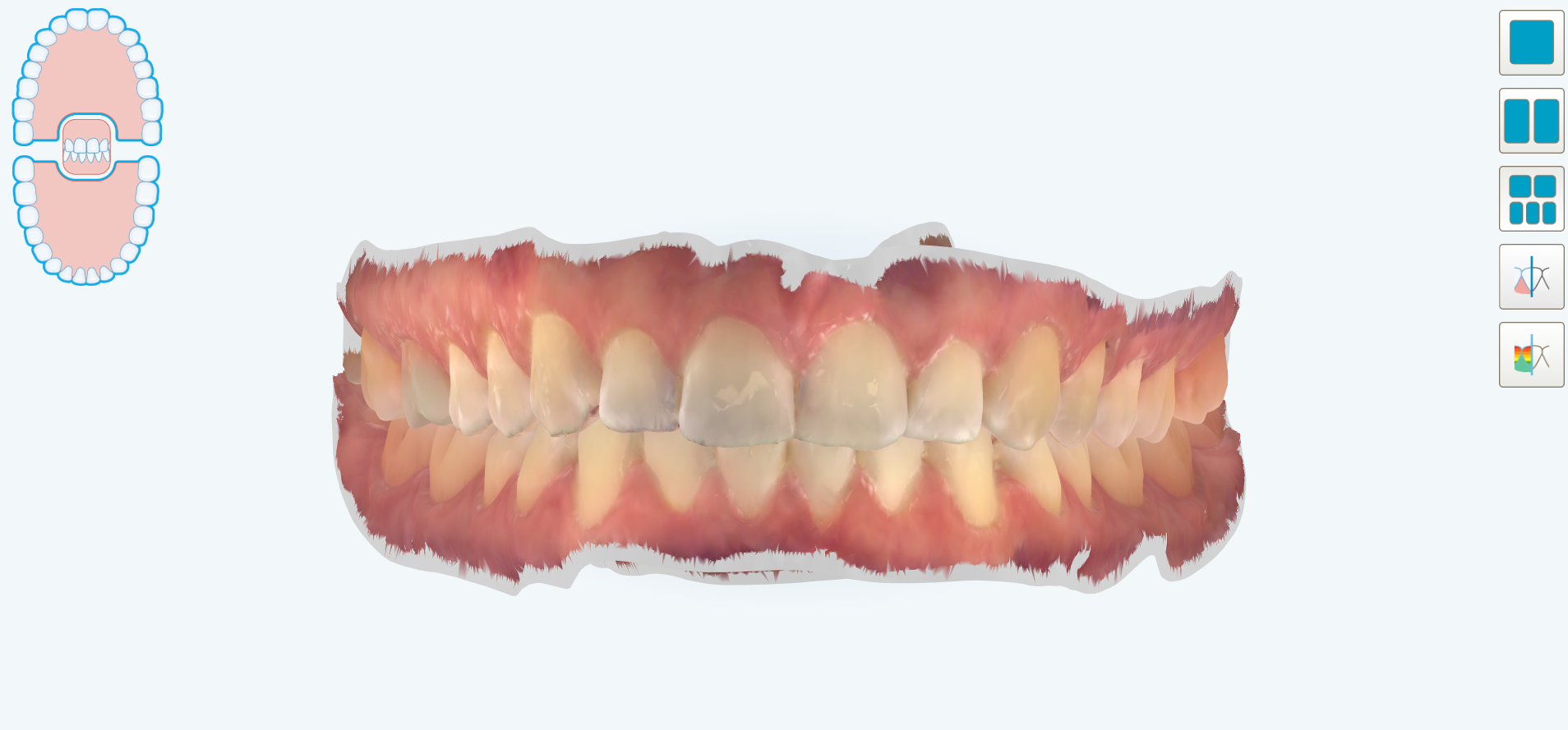 Buste Protettive Taglia 2 500 Buste Dentali Per Scansione Piastre Al Fosforo - Taglia 2, Barriera A Raggi X, Per Radiologia Digitale Buste Dentali Taglia 2 - Foto 3