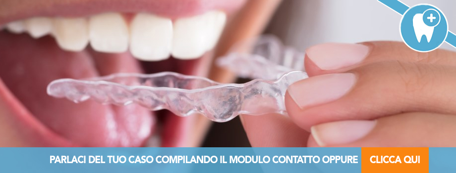 4 Pezzi Bite Bruxismo Notturno, 2 Taglie Paradenti Per Digrignare I Denti, Modellabile Mouth Guard,Migliora Bite Bruxismo, Antirussamento,Per Migliora La Qualità Del Sonno, Unisex - Foto 6
