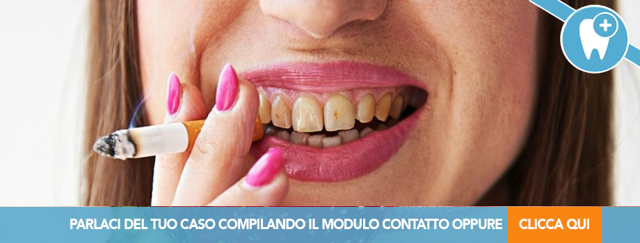 la sigaretta elettronica fa ingiallire i denti 🦷I vapes macchiano i denti come le sigarette main image 0