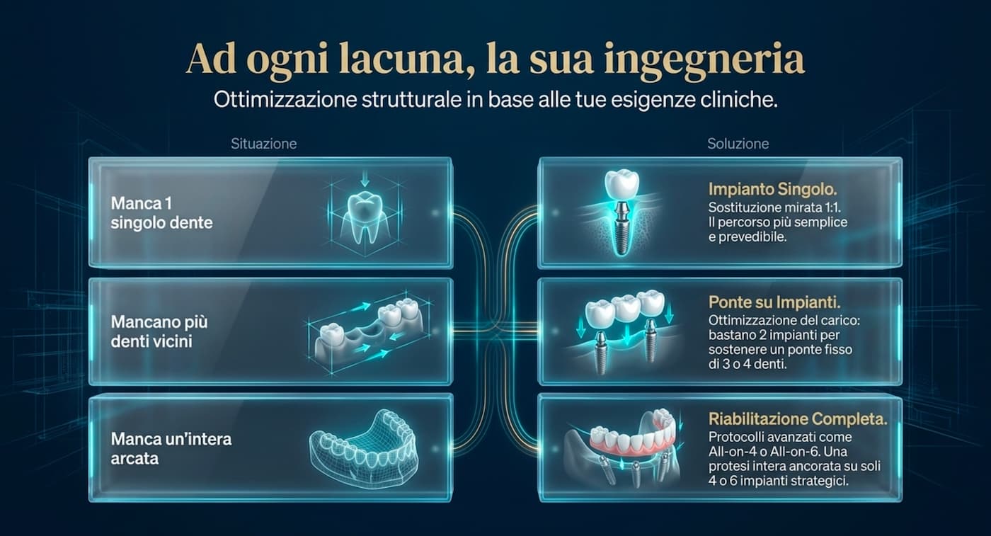 Ad ogni lacuna la sua ingegneria: impianto singolo, ponte su impianti, riabilitazione completa All-on-4 o All-on-6