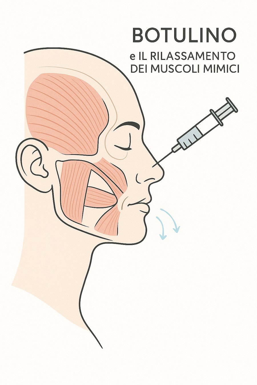 Illustrazione dei muscoli mimici del viso e azione rilassante della tossina botulinica