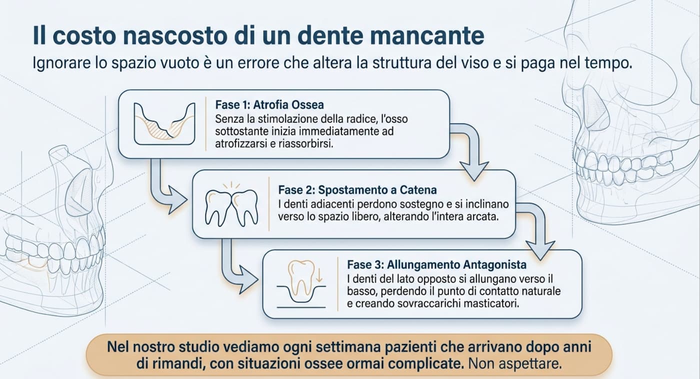Le conseguenze di un dente mancante: riassorbimento osseo e spostamento dei denti