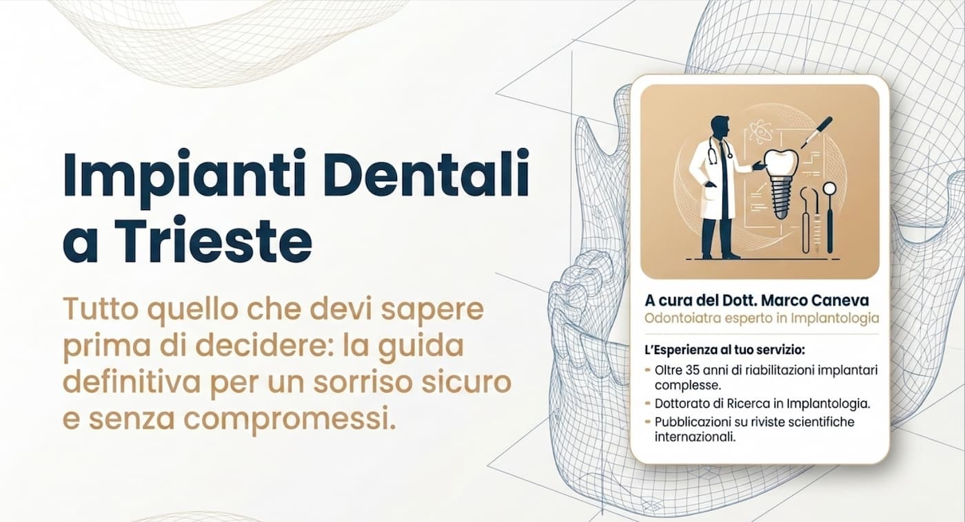 Impianti dentali a Trieste – Guida del Dott. Marco Caneva, Studio Dentistico Caneva